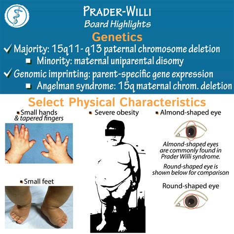 prader willi syndrome deletion